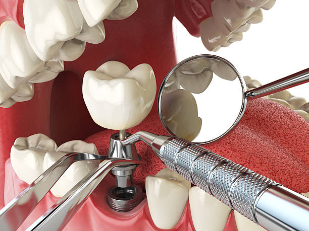Best Orthodontic Emergency Dentist in Young Harris, GA